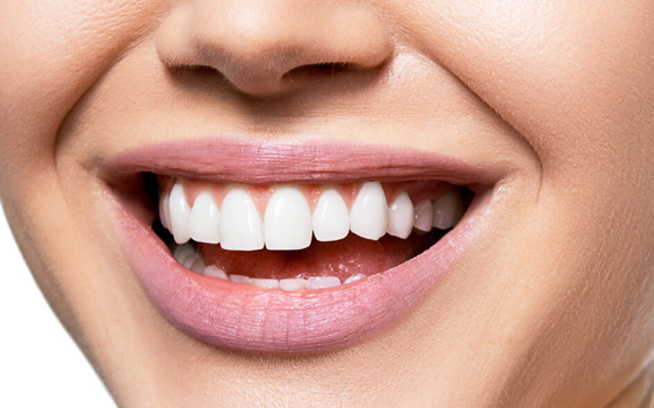 Teeth Whitening in Tallahassee Whitening Dentist Near You
